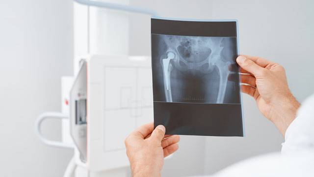 medico guarda radiografia osso sacro